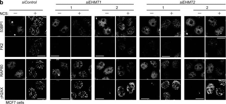 Immunocytochemistry/ Immunofluorescence: RAP80 Antibody [NBP1-87156] - EHMT1 & EHMT2 are required for accumulation of ubiquitin conjugates & repair factors at DNA damage sites. (a,b) Immunofluorescence analysis of U2OS cells (a) & MCF7 (b) cells transfected with indicated siRNA, & co-immunostained with indicated antibodies at 2 h after exposure to neocarzinostatin (NCS, 50 ng/ml for 15 min). A representative image of each treated or control cells is shown, as indicated. DNA damage induced foci are quantified as the percentage of cells with more than 5 large foci in nuclei after background subtraction, each based on at least 150 cells from three independent experiments (right). Error bars represent standard deviation (SD). Statistical significance was calculated using two-tailed, unpaired t-test compared with control cells; *P < 0.0001. The knockdown efficiencies with individual siRNAs against EHMT1 & EHMT2 are shown in Fig. S3a,b. Scale bar, 10 μm. Image collected & cropped by CiteAb from the following publication (//pubmed.ncbi.nlm.nih.gov/30022091), licensed under a CC-BY license. Not internally tested by Novus Biologicals.