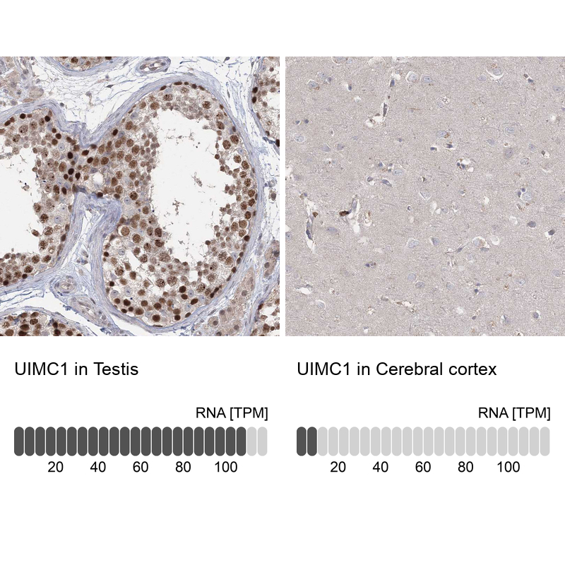 <b>Orthogonal Strategies Validation. </b>Analysis in human testis and cerebral cortex tissues. Corresponding RNA-seq data are presented for the same tissues.