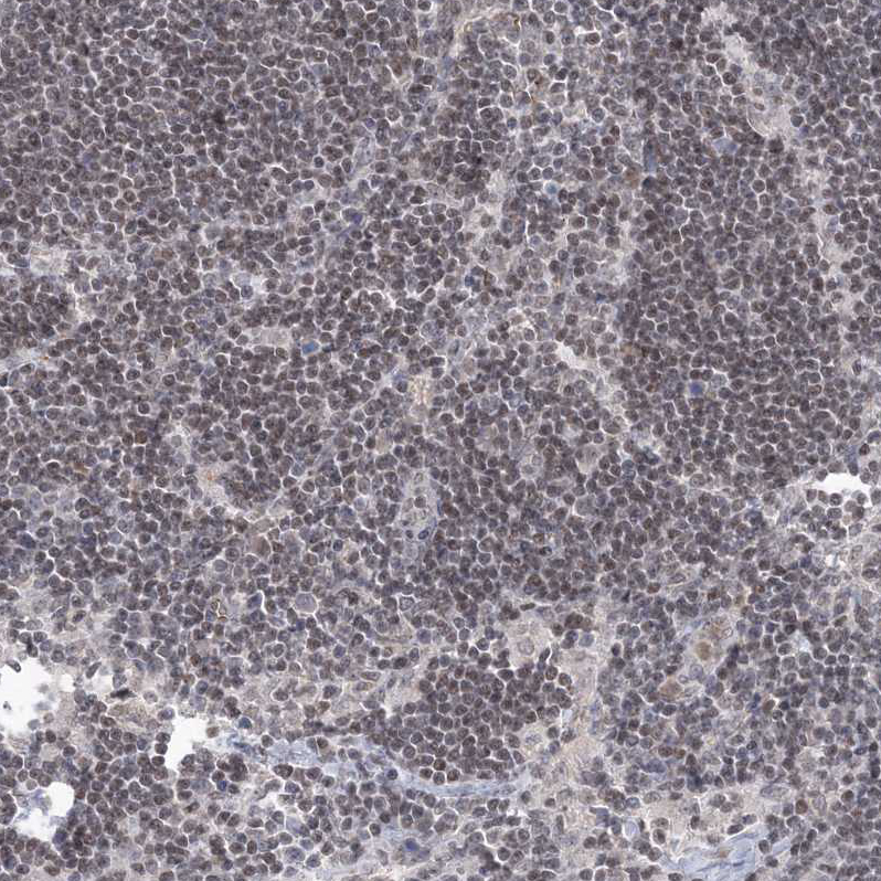 Staining of human lymph node shows moderate nuclear positivity in non-germinal center cells.