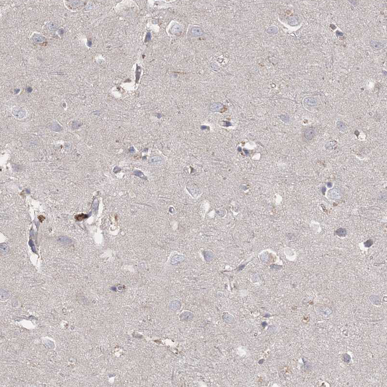 Staining of human cerebral cortex shows no positivity in neurons as expected.