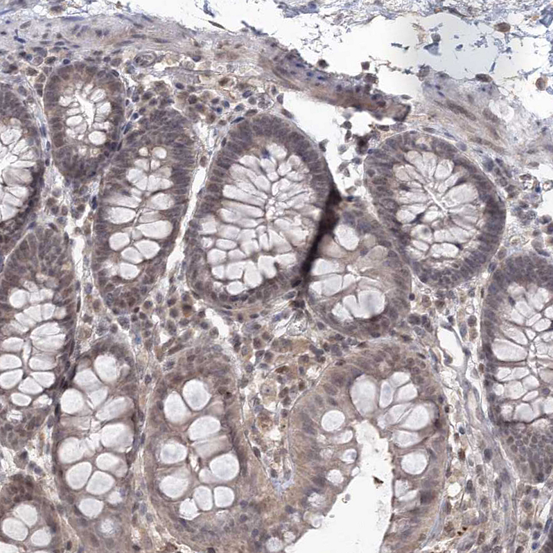 Staining of human colon shows moderate nuclear positivity in glandular cells.