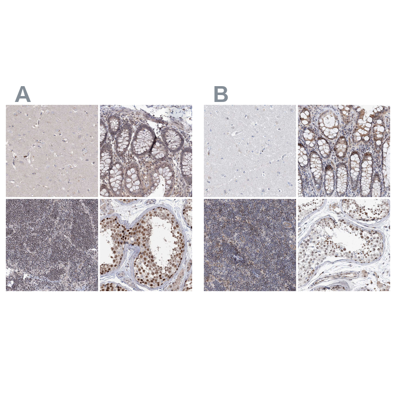 <b>Orthogonal Strategies Validation. </b>Staining of human cerebral cortex, gastrointestinal, lymphoid tissues and testis HPA037503 (A) shows similar protein distribution across tissues to independent antibody HPA037504 (B).