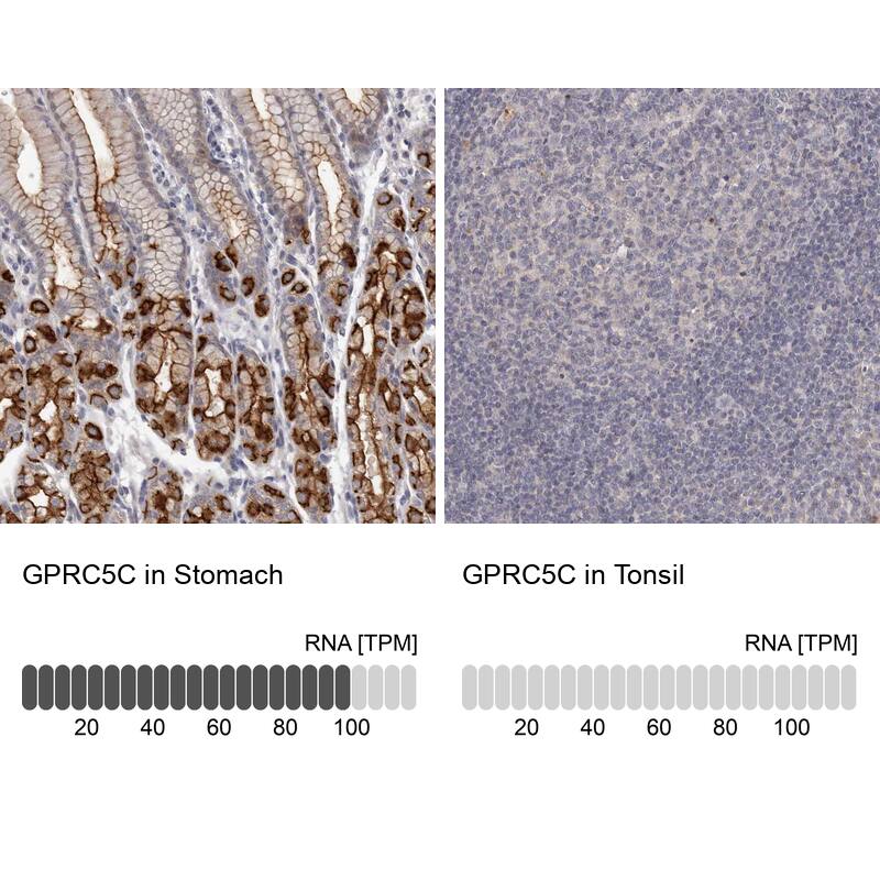 <b>Orthogonal Strategies Validation. </b>Analysis in human stomach and tonsil tissues. Corresponding RNA-seq data are presented for the same tissues.