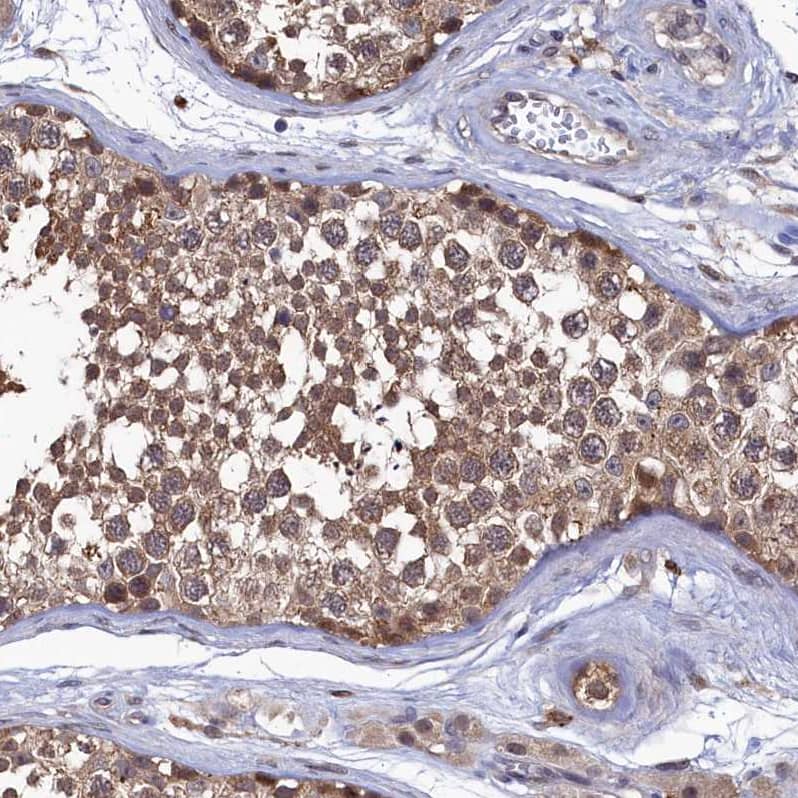 Staining of human testis shows strong cytoplasmic positivity in cells in seminiferous ducts.