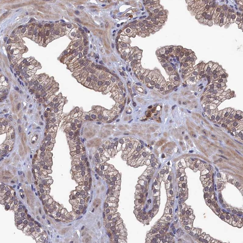 Staining of human prostate shows moderate cytoplasmic positivity in glandular cells.