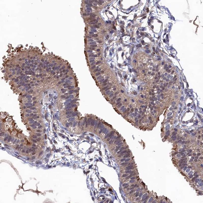 Staining of human fallopian tube shows moderate cytoplasmic positivity in glandular cells.