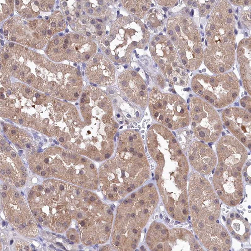 Staining of human kidney shows moderate cytoplasmic positivity in cells in tubules.