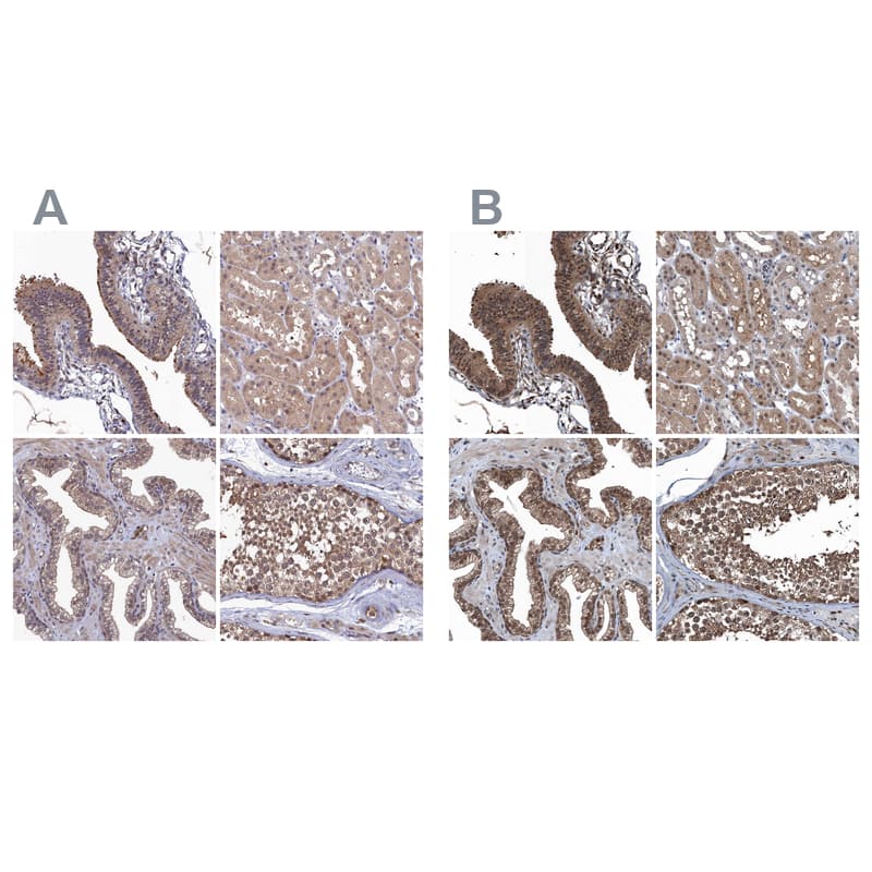 <b>Orthogonal Strategies Validation. </b>Staining of human fallopian tube, kidney, prostate and testis HPA040781 (A) shows similar protein distribution across tissues to independent antibody HPA039223 (B).