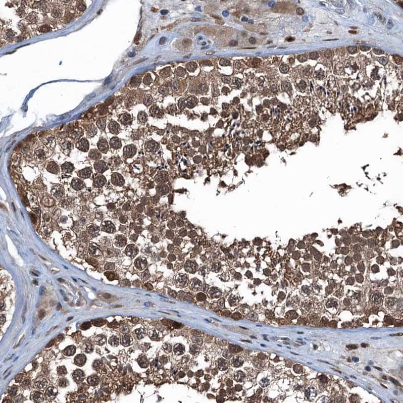 Staining of human testis shows strong cytoplasmic positivity in cells in seminiferous ducts.