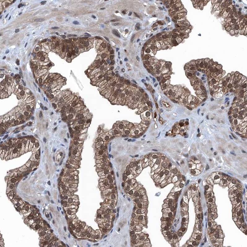 Staining of human prostate shows strong cytoplasmic positivity in glandular cells.