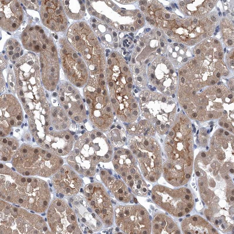 Staining of human kidney shows moderate cytoplasmic positivity in cells in tubules.