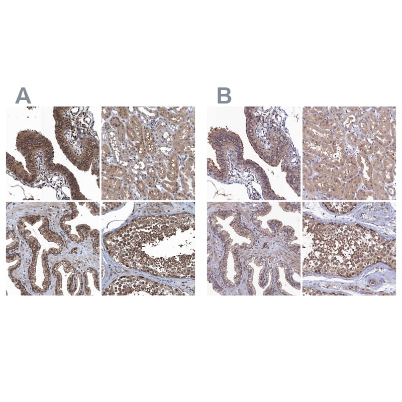 <b>Orthogonal Strategies Validation. </b>Staining of human fallopian tube, kidney, prostate and testis HPA039223 (A) shows similar protein distribution across tissues to independent antibody HPA040781 (B).