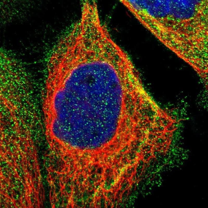 Staining of human cell line A-431 shows localization to plasma membrane & vesicles.