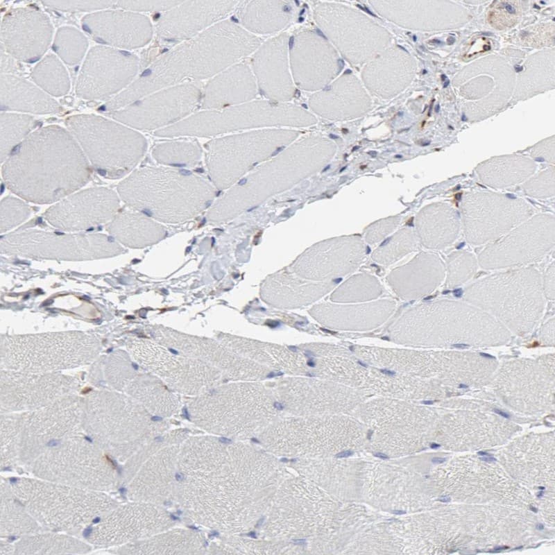 Immunohistochemistry-Paraffin RAB9A Antibody - BSA Free