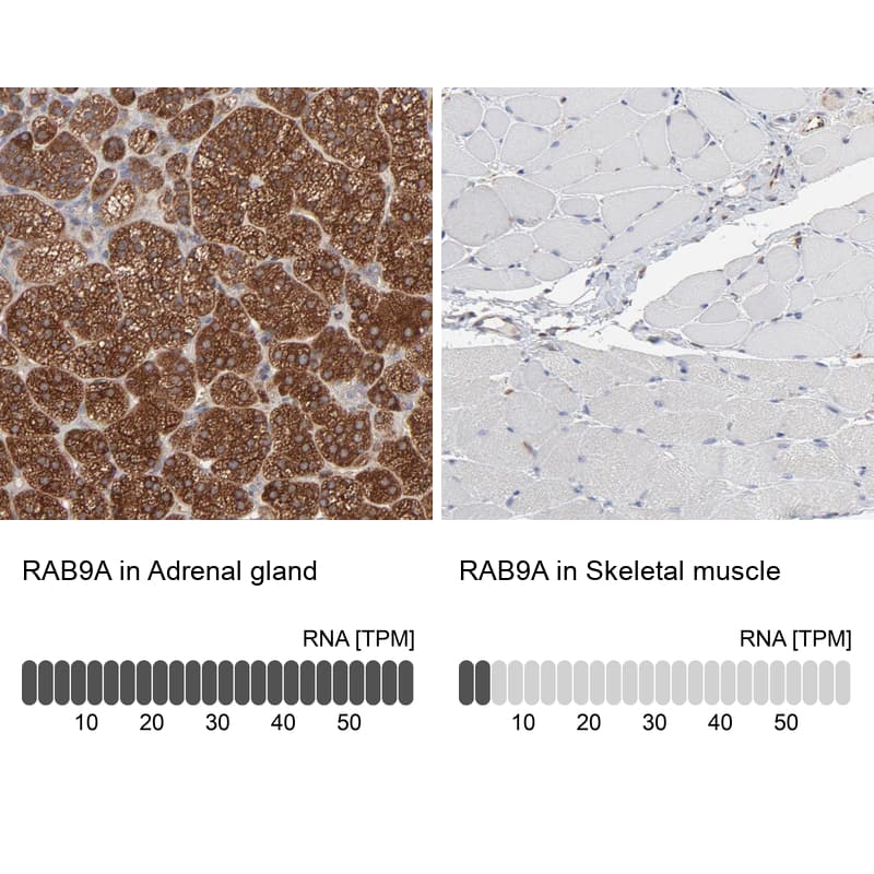 Immunohistochemistry-Paraffin RAB9A Antibody - BSA Free