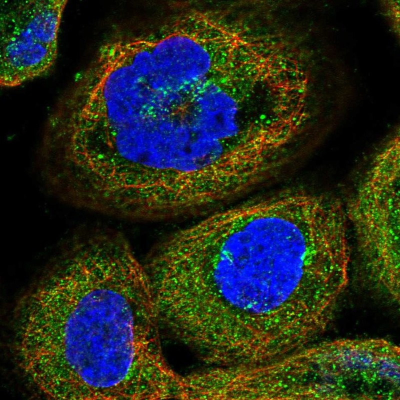 Staining of human cell line A-431 shows localization to cytosol & the Golgi apparatus.