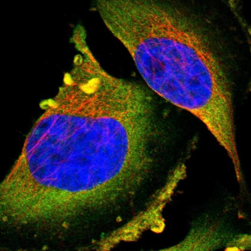 Staining of human cell line U-251 MG shows positivity in plasma membrane & cytoplasm.