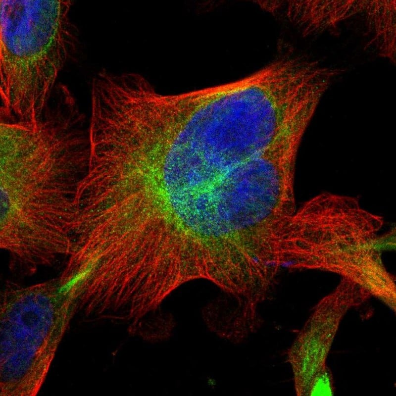 Staining of human cell line U-251 MG shows localization to intermediate filaments.