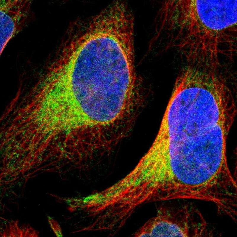Staining of human cell line U-2 OS shows positivity in endoplasmic reticulum.