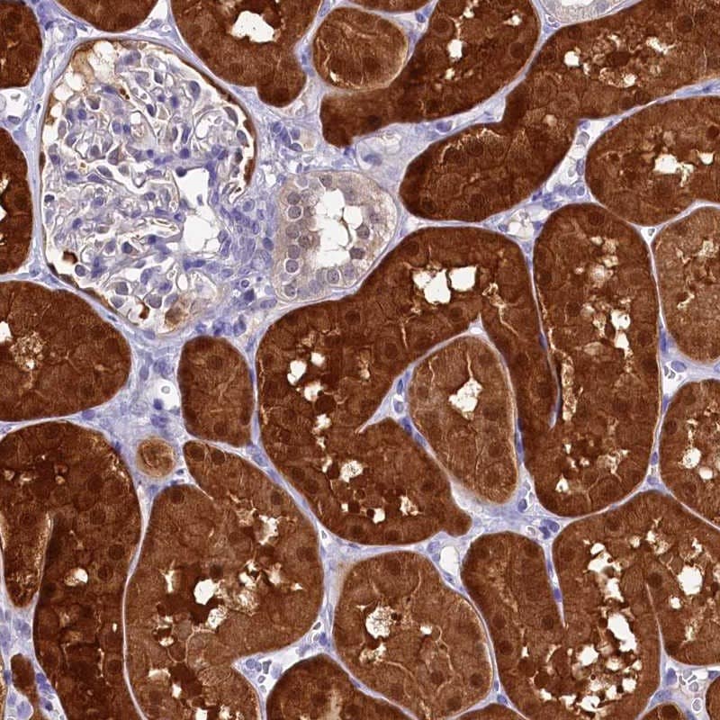 Staining of human kidney shows strong cytoplasmic and nuclear positivity in cells in tubules.