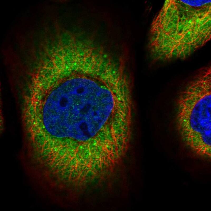 Staining of human cell line A-431 shows localization to cytosol.