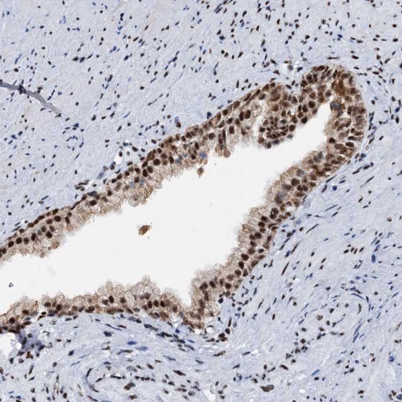 Staining of human prostate shows strong nuclear positivity in glandular cells.