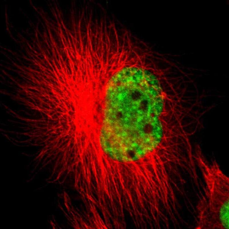 Staining of human cell line U-251 MG shows localization to nuclear speckles.