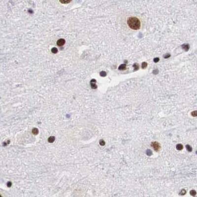 Staining of human cerebral cortex.