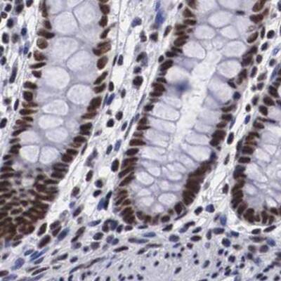Staining of human colon.