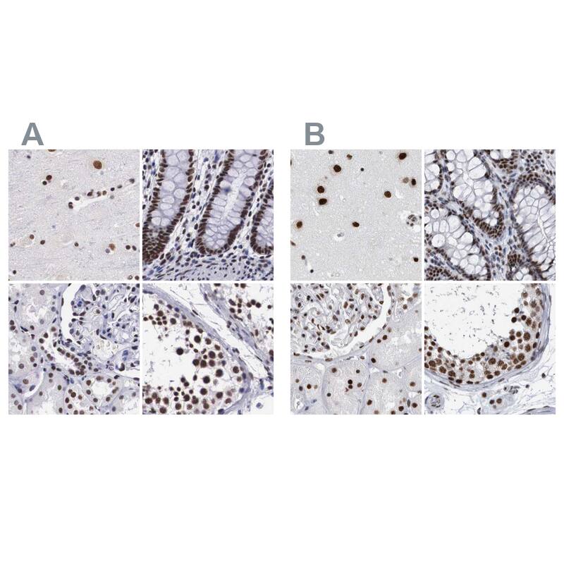 <b>Orthogonal Strategies Validation. </b>Staining of human cerebral cortex, colon, kidney and testis HPA000690 (A) shows similar protein distribution across tissues to independent antibody HPA030083 (B).