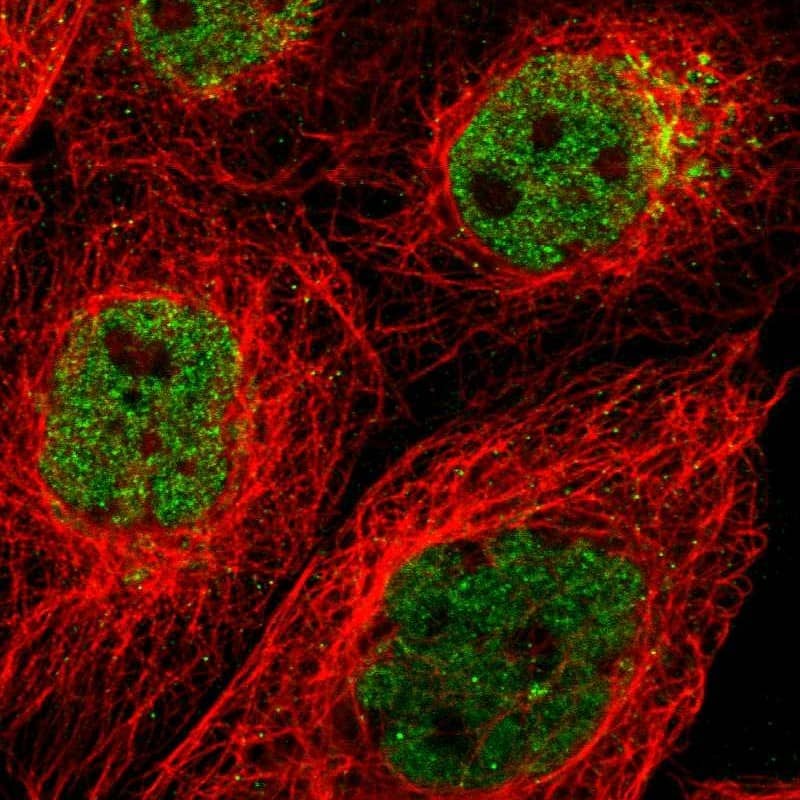 Staining of human cell line A-431 shows localization to nucleoplasm & the Golgi apparatus.