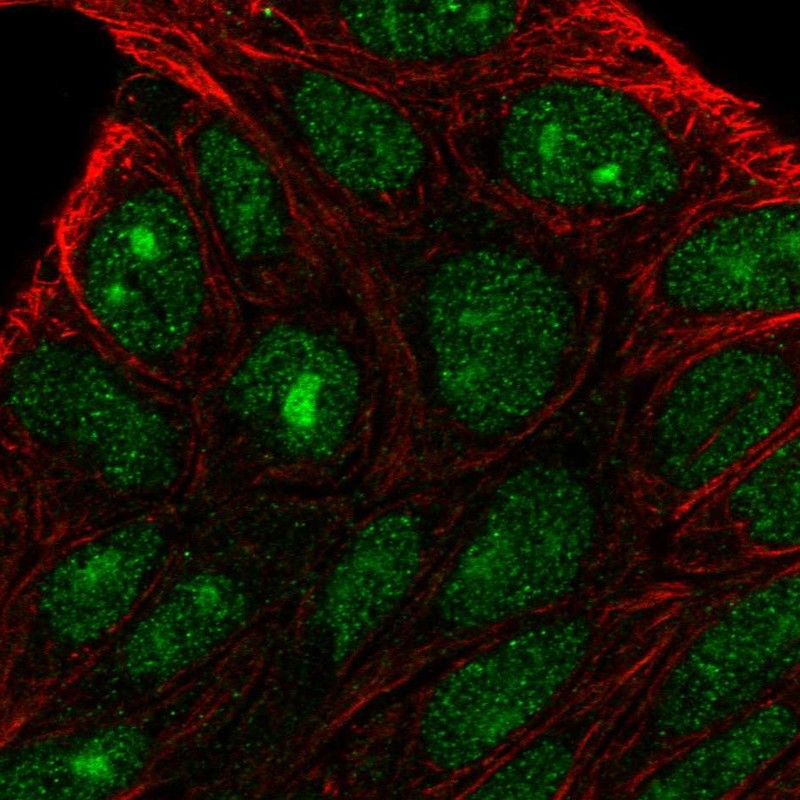 Staining of human cell line RT4 shows localization to nucleus & nucleoli.