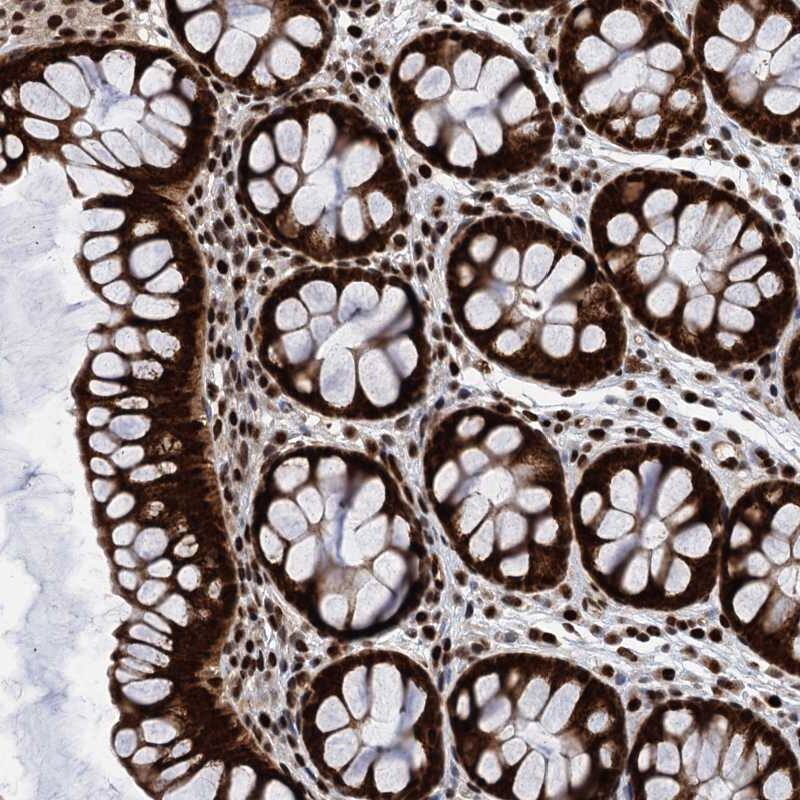 Staining of human colon shows strong nuclear and cytoplasmic positivity in glandular cells.
