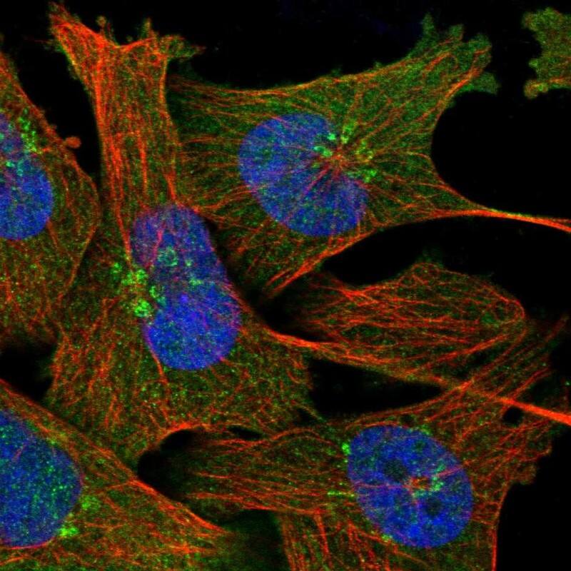 Staining of human cell line U-251 MG shows localization to nucleoplasm, cytosol & the Golgi apparatus.