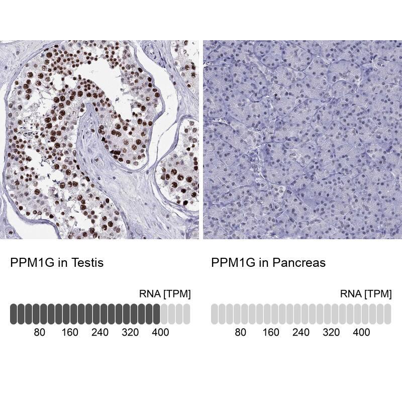 <b>Orthogonal Strategies Validation. </b>Analysis in human testis and pancreas tissues. Corresponding RNA-seq data are presented for the same tissues.