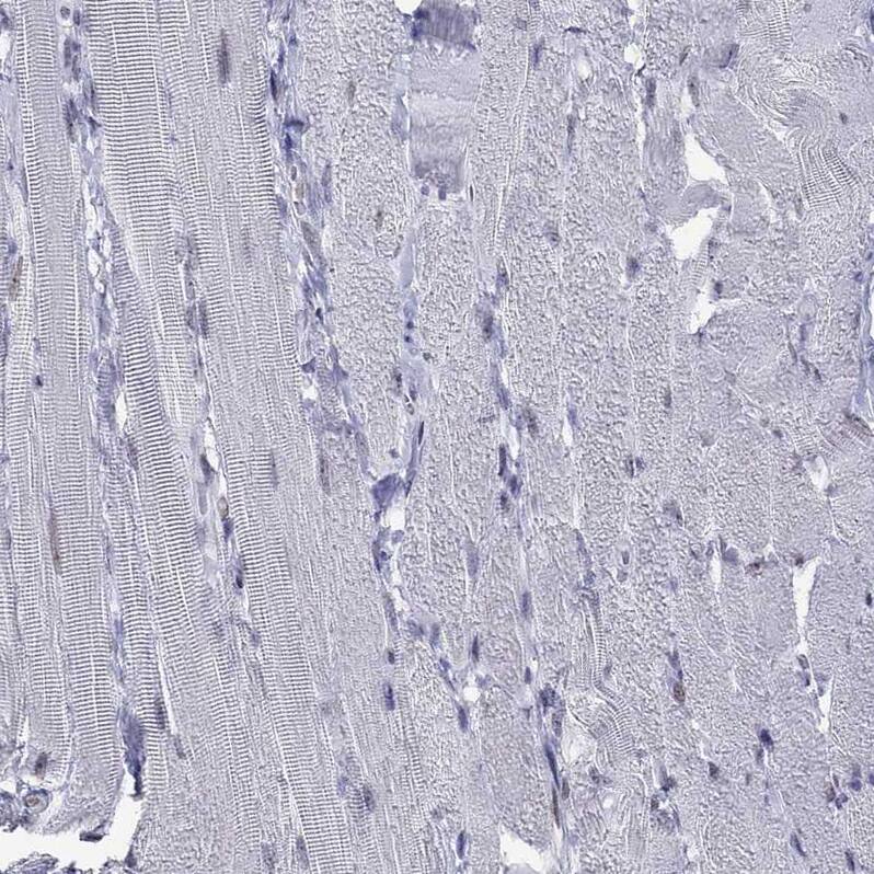 Staining of human skeletal muscle shows no positivity in myocytes as expected.