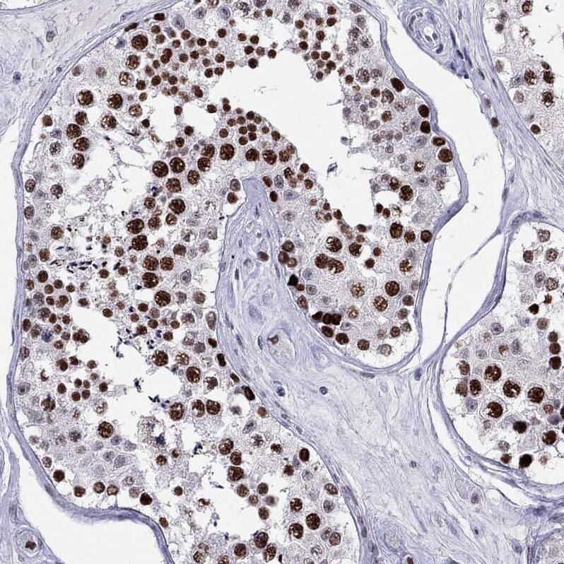 Staining of human testis shows strong nuclear positivity in cells in seminiferous ducts.