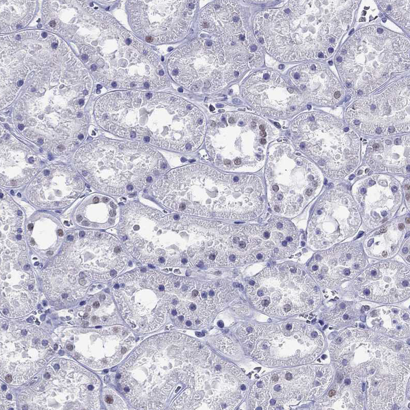 Staining of human kidney shows no positivity in cells in tubules as expected.