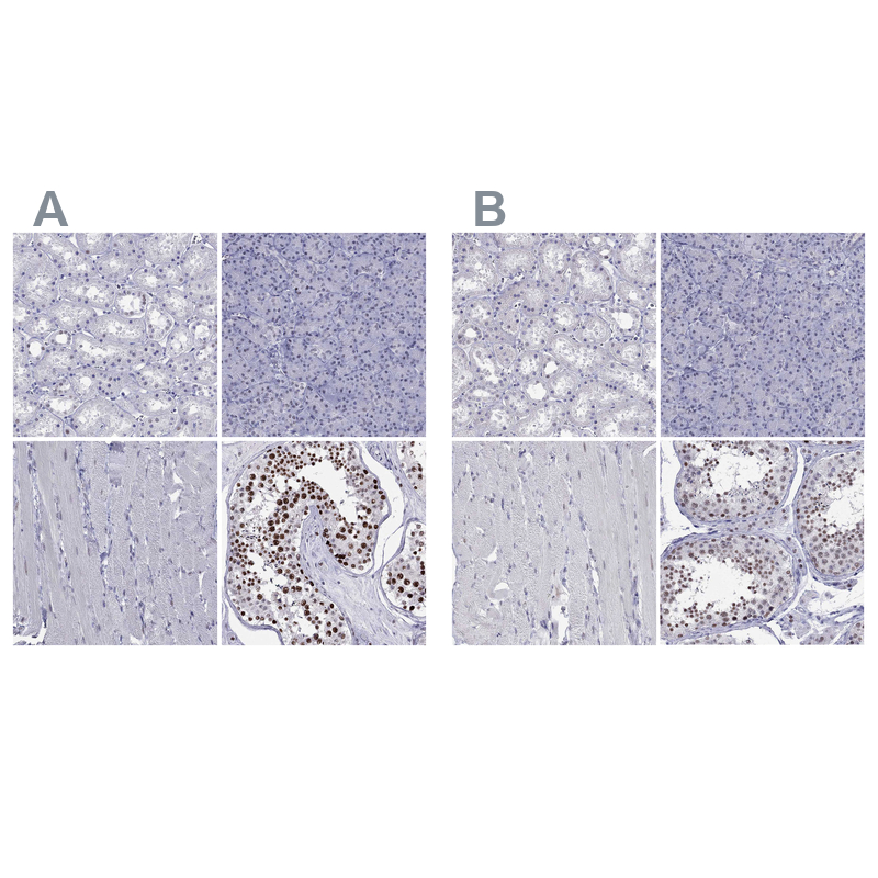 <b>Orthogonal Strategies Validation. </b>Staining of human kidney, pancreas, skeletal muscle and testis HPA035530 (A) shows similar protein distribution across tissues to independent antibody HPA035531 (B).