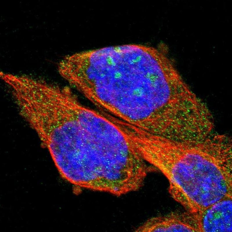 Staining of human cell line A-431 shows positivity in nucleoli & cytoplasm.