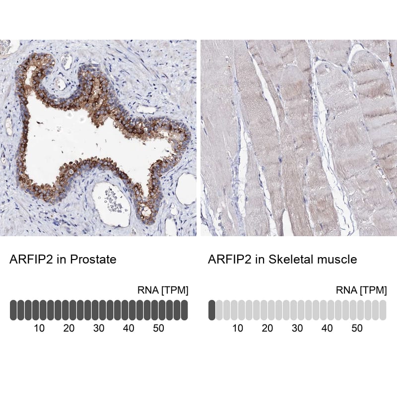 Immunohistochemistry-Paraffin ARFIP2 Antibody - BSA Free