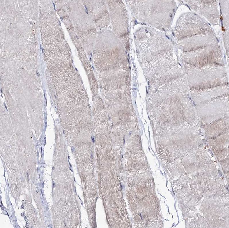 Staining of human skeletal muscle shows no cytoplasmic positivity in myocytes as expected.