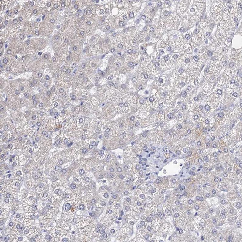 Staining of human liver shows no positivity in hepatocytes as expected.