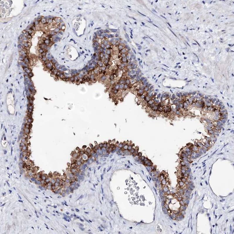 Staining of human prostate shows strong cytoplasmic positivity in glandular cells.