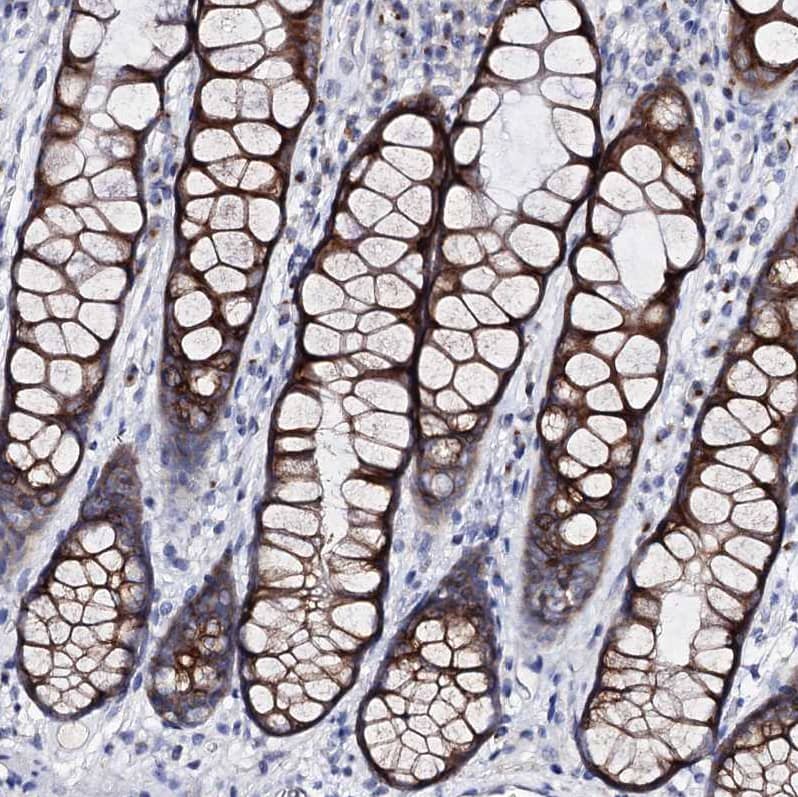 Staining of human colon shows strong cytoplasmic positivity in glandular cells.