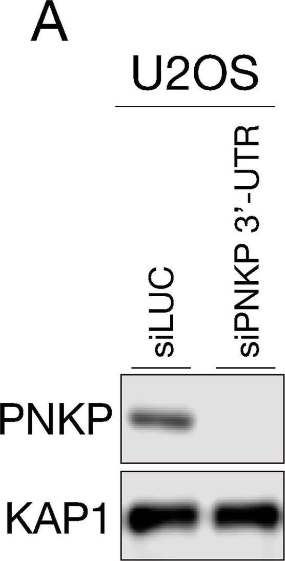 Western Blot: PNK Antibody [NBP1-87257] - Lysine 138, arginine 139 & arginine 141 are important for efficient DNA repair.(A) PNKP depletion by 3’-UTR siRNA PNKP was confirmed by western blot analysis. KAP1 antibody was used for loading control. (B) DNA DSB repair efficiency was analyzed by immunofluorescence using  gamma -H2AX antibody after IR exposure in GFP-PNKP & 3’-UTR siRNA PNKP-transfected U2OS cells. Graph represented percentage of  gamma -H2AX positive cells with 10 ≧  gamma -H2AX foci. At least 200 cells were counted & experiments were performed 3 times independently. (C) DNA SSB repair efficiency was analyzed by immunofluorescence using PAN-ADP-ribose binding reagents at 30 mins after IR exposure in GFP-PNKP & 3’-UTR siRNA PNKP-transfected U2OS cells treated with 10μM of poly (ADP-ribose) glycohydrolase inhibitor (PARGi) for 30 mins prior to IR exposure. (D) Graph represented the intensity of ADP ribose. At least 100 cells were counted & experiments were performed 3 times independently. Error bars indicate the standard error of the mean (SEM). ns: not significant (p > 0.05); **: 0.005 < p ≦ 0.01; ****: 0.0005 < p ≦ 0.001. Image collected & cropped by CiteAb from the following publication (//pubmed.ncbi.nlm.nih.gov/32970693), licensed under a CC-BY license. Not internally tested by Novus Biologicals.