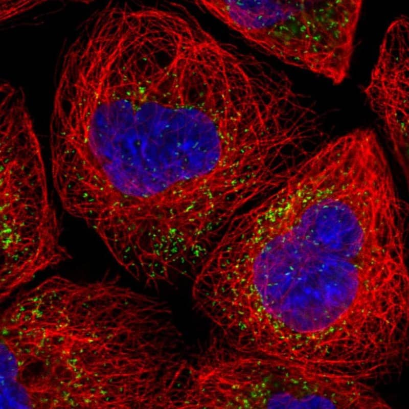 Staining of human cell line A-431 shows localization to peroxisomes.