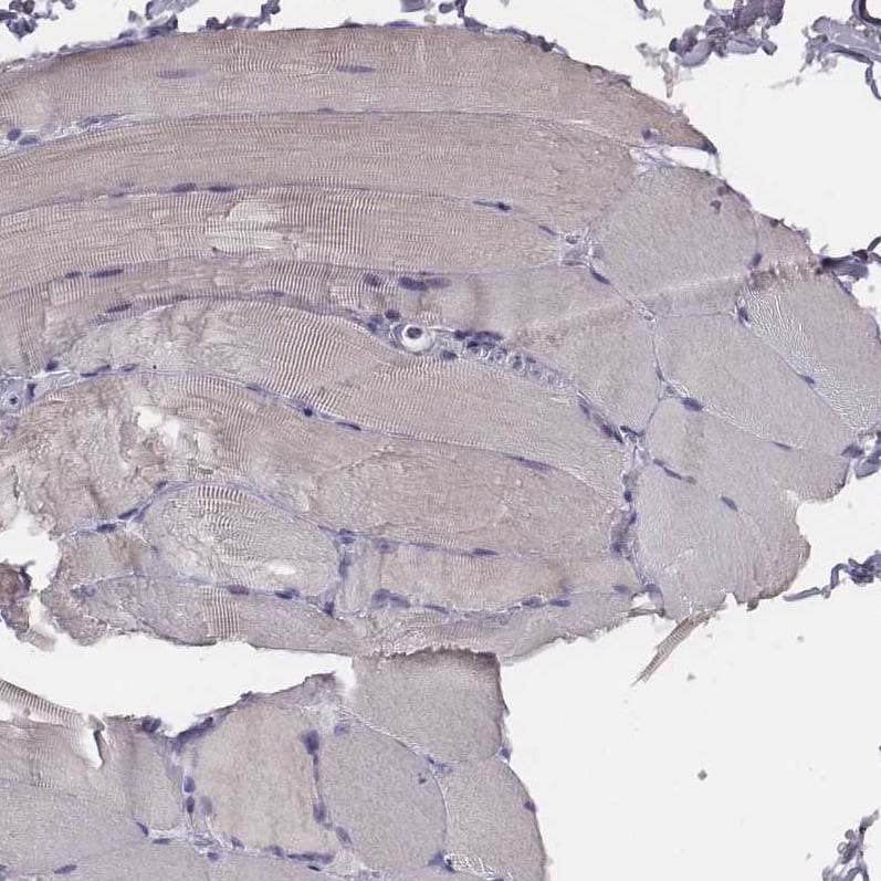 Staining of human skeletal muscle shows no positivity in myocytes as expected.
