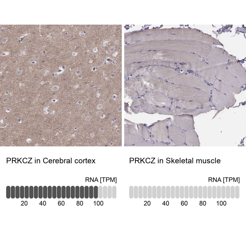 <b>Orthogonal Strategies Validation. </b>Analysis in human cerebral cortex and skeletal muscle tissues. Corresponding RNA-seq data are presented for the same tissues.