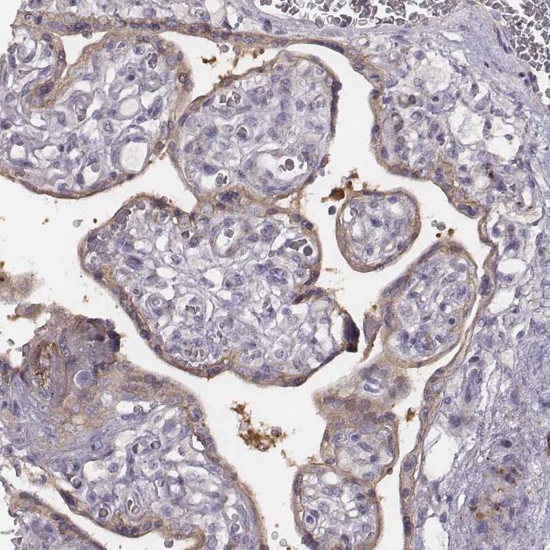 Staining of human placenta shows weak cytoplasmic positivity in trophoblastic cells.